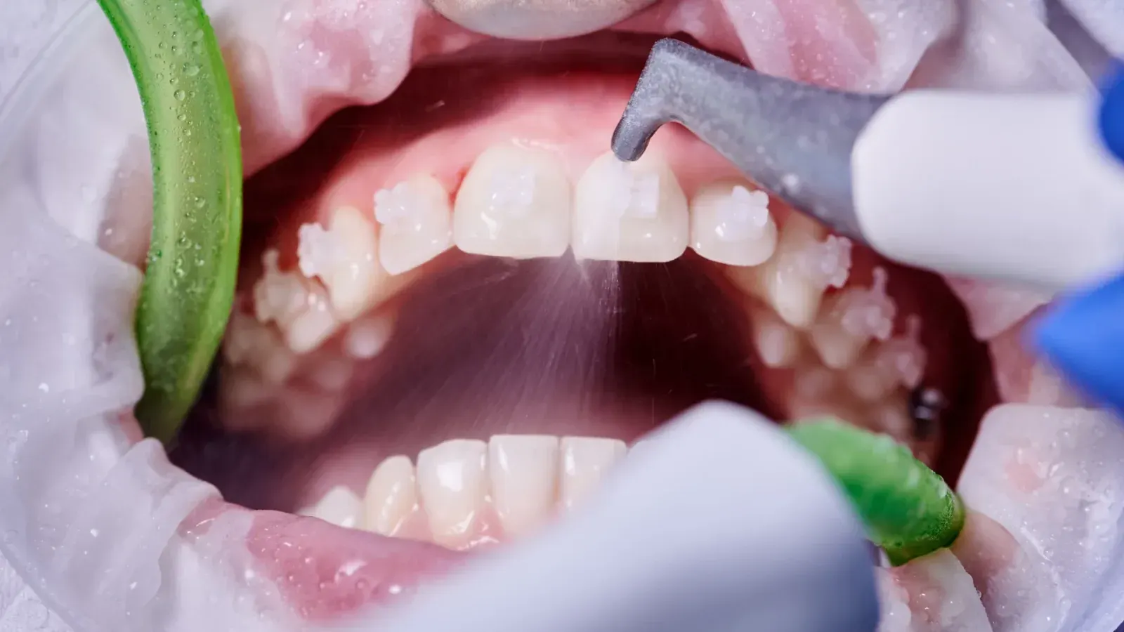 Gum & Oral Care