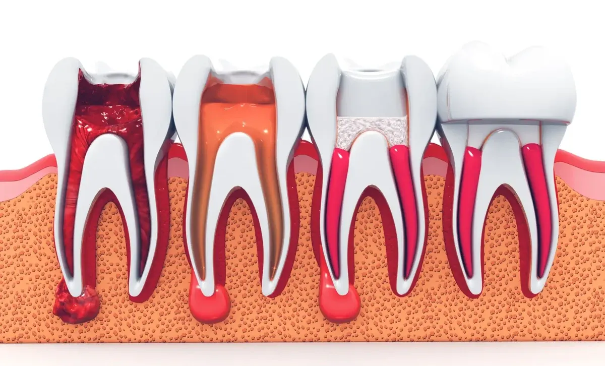 Restorative Dentistry